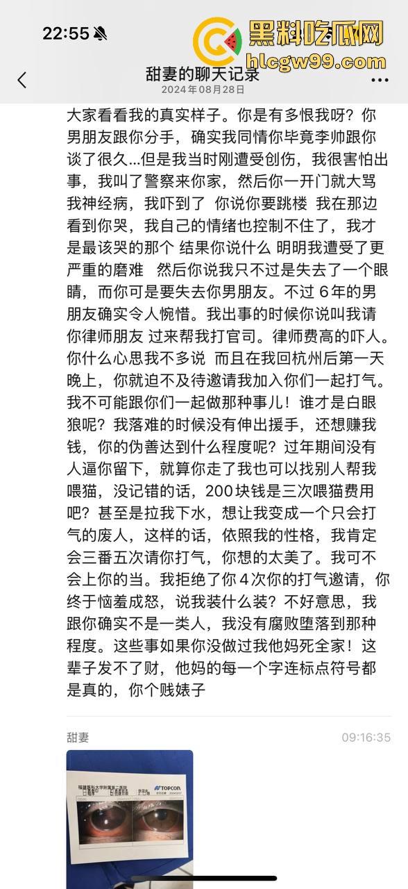 【夜场故事会】杭州混圈公主SM玩脱，被打爆一只眼，差点丢命！女生互撕背刺，骂战升级，闺蜜情比塑料还薄！-5