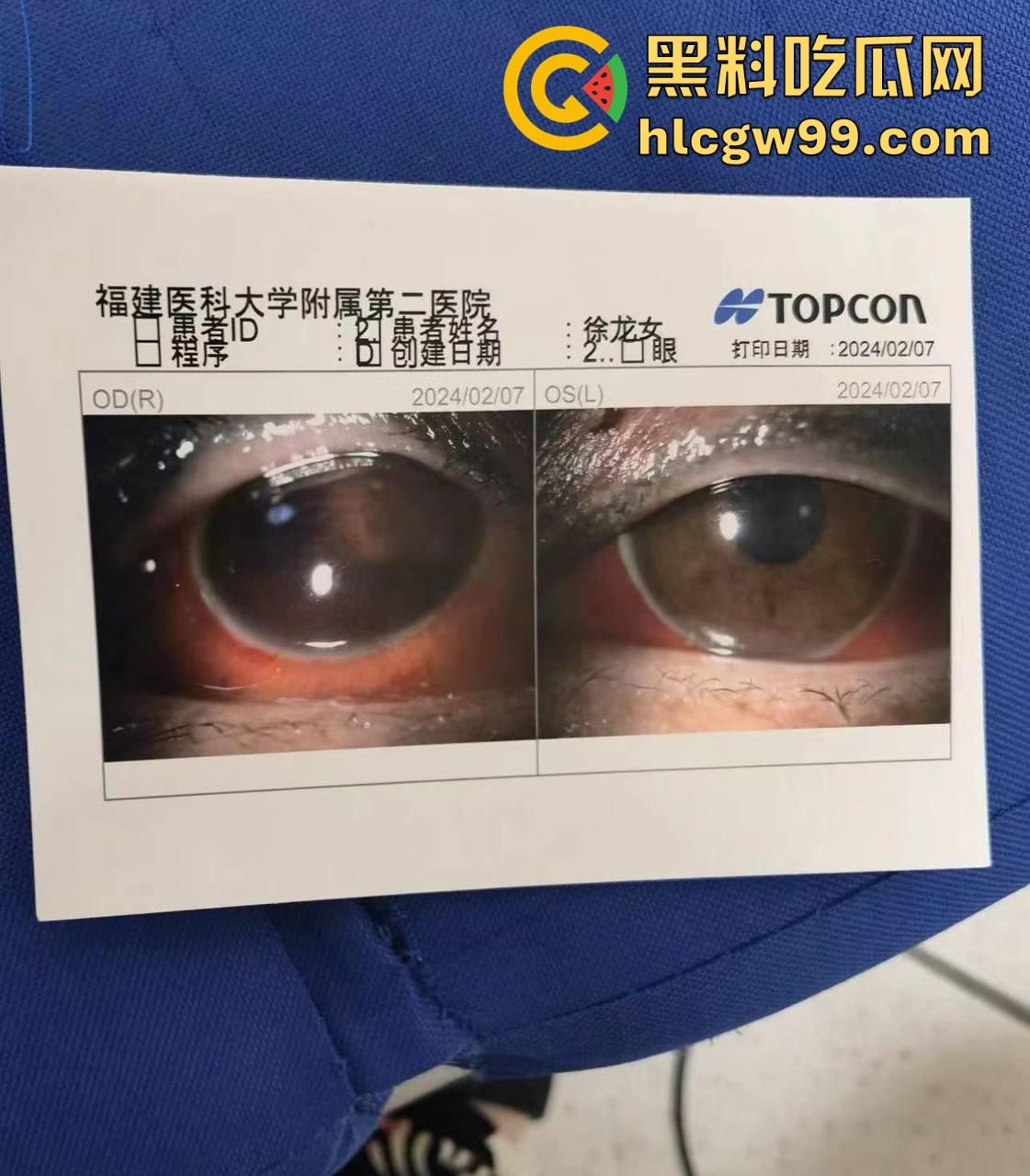 【夜场故事会】杭州混圈公主SM玩脱，被打爆一只眼，差点丢命！女生互撕背刺，骂战升级，闺蜜情比塑料还薄！-7