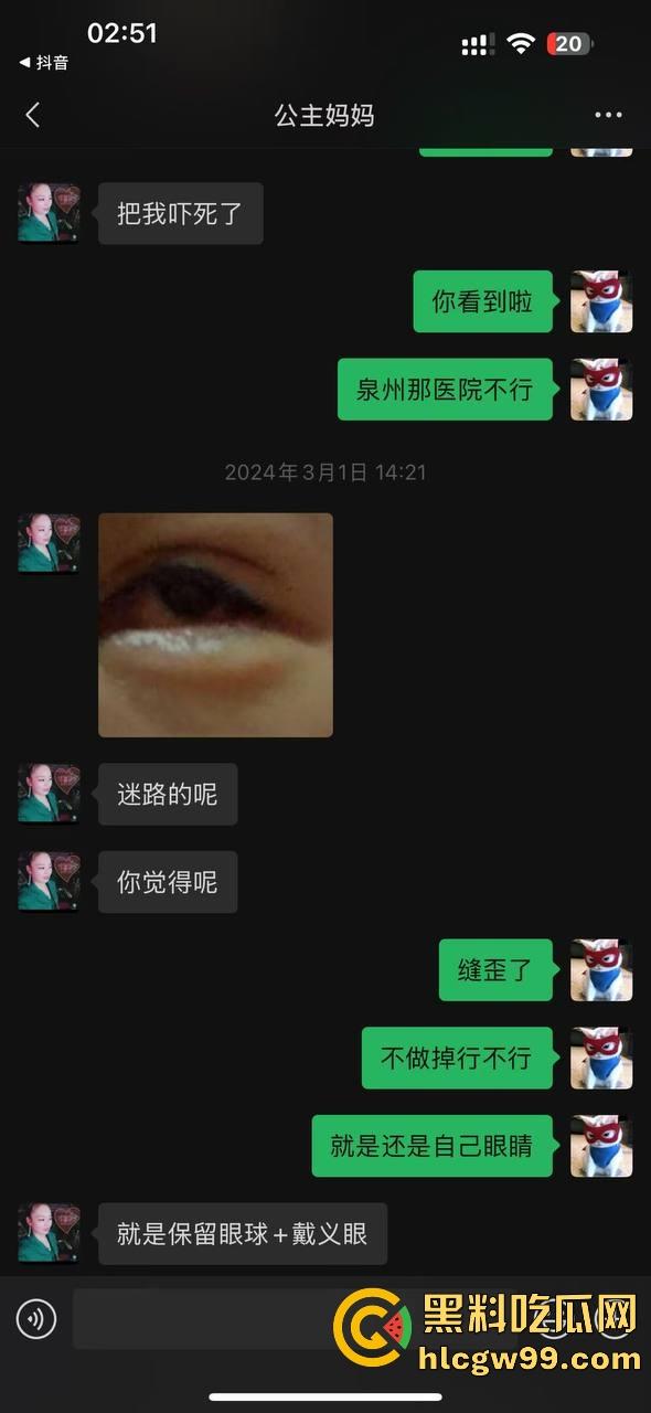 【夜场故事会】杭州混圈公主SM玩脱，被打爆一只眼，差点丢命！女生互撕背刺，骂战升级，闺蜜情比塑料还薄！-133