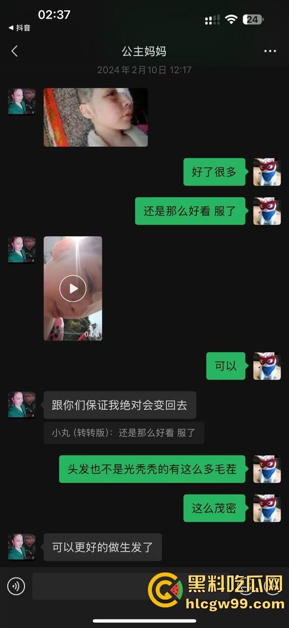【夜场故事会】杭州混圈公主SM玩脱，被打爆一只眼，差点丢命！女生互撕背刺，骂战升级，闺蜜情比塑料还薄！-159