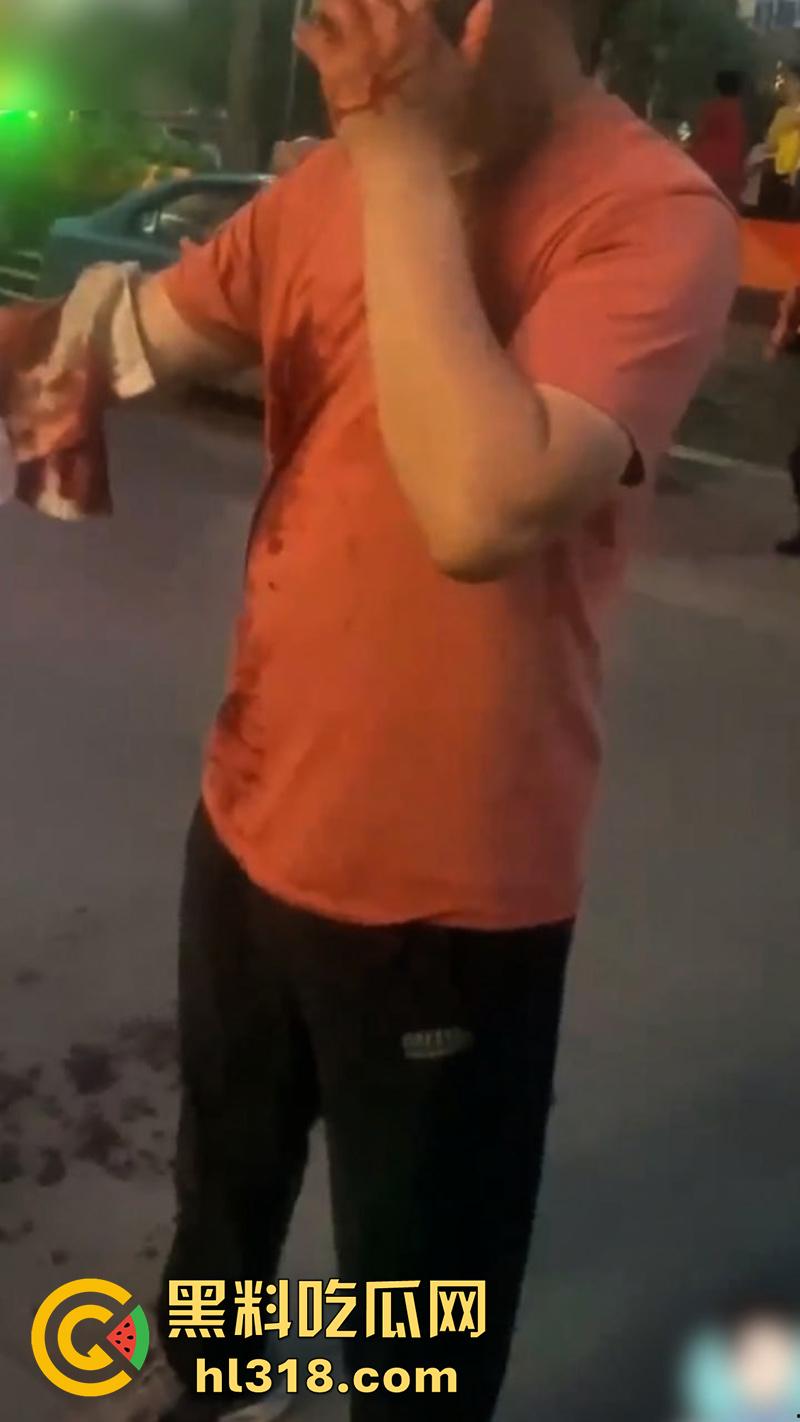 秦皇岛红桥里砍人事件,持刀报复社会在大街上见人就砍,据说有20多人被砍,目前人已被逮捕!-1