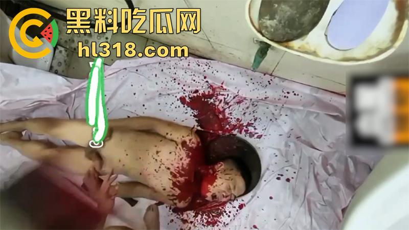 暗网恐怖性虐合集,铁钳拔乳头女尸法检,放狗啃食鸡鸡,撸管被当场剁头切割阴茎,场面血腥胆小者勿入!-2