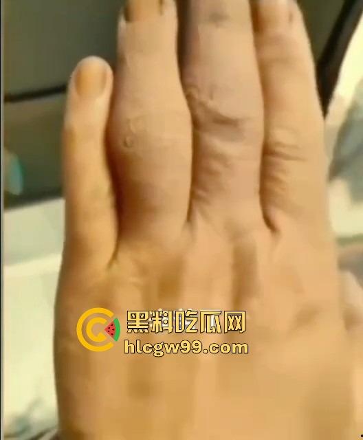 广州护士实习生『蓝美淇』开学前急约一炮,轻微洁癖却爱被抠逼,抠到手水肿,这逼是真湿还是有毒?-11