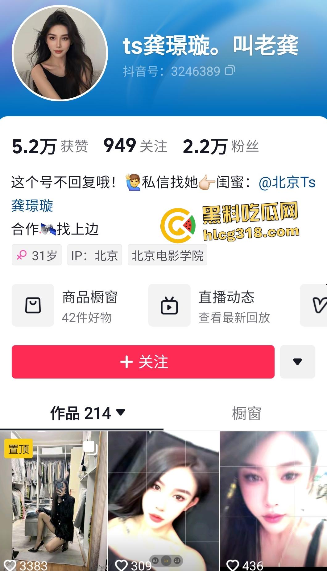 抖音【龚璟璇】人妖绿茶婊翻车!黑丝口交被秃顶金主内射,鸡鸡对鸡鸡比人体蜈蚣还骚!-1